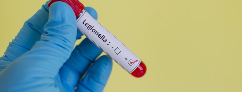Prevenir la legionella en casa - ID Control de Plagas