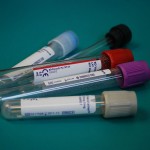Legionella pneumophila lo que tenemos que saber